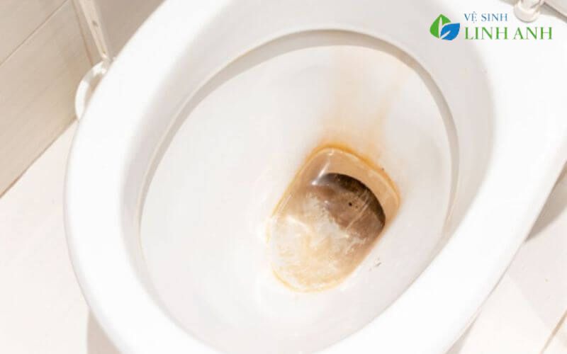 vì sao cần giữ nhà vệ sinh luôn sạch khuẩn